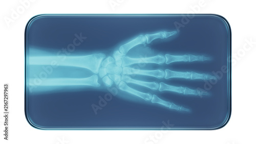 Konstfotografi Glass Frame with X-Ray Human Wrist Anatomy Medical Illustration