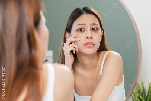 Quadro su tela lack of sleep problem, Worried Asian young woman pointing finger at dark circles