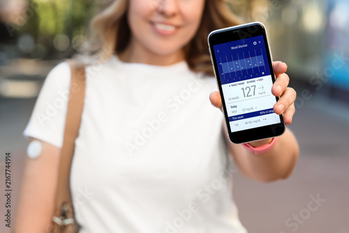 Diabetic woman with glucose sensor using mobile phone for measuring blood sug...