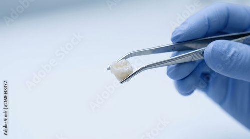 Dentist holding natural tooth with sterile metal forceps in blue gloves during dental extraction procedure