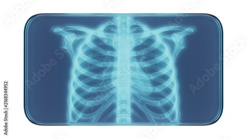 Quadro su tela Glass Frame with X-Ray Rib Cage Medical Illustration