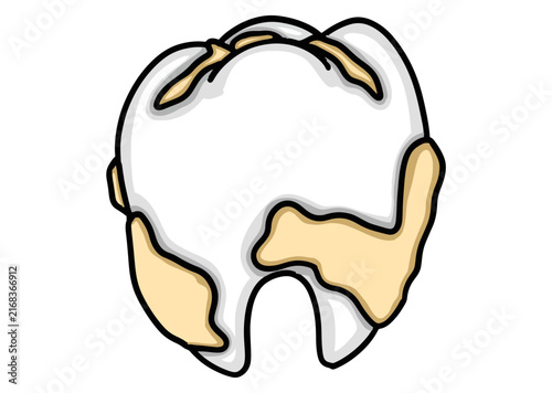 Teeth covered in tartar signify teeth that are neither clean nor healthy
