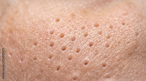 Close up of human skin with visible pores and texture.