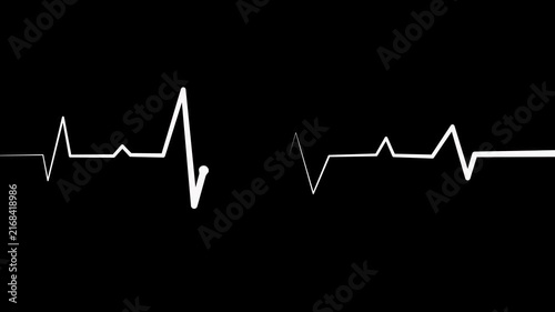 Irregular heartbeat line flat start and end, showing a medical ecg pattern and heart rhythm problem animation