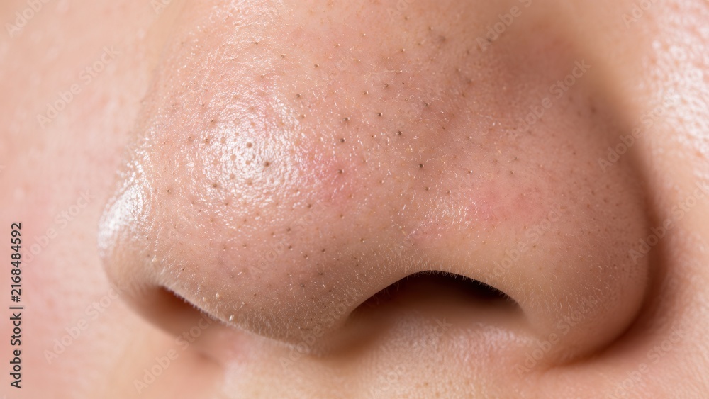 Naklejka premium Close up macro of nose with visible blackheads enlarged pores and oily skin texture for dermatology concept