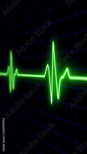 Close-up video of a green heartbeat line on a black grid, viewed from a straight angle. Live mobile wallpaper.