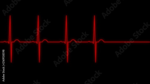 Red EKG ECG Heart Rate Pulse Monitoring Line Animating and Flatlining on a Black Background