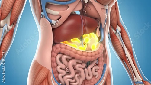 Medical animation depicting the development of pancreatic cancer, showing the tumor growing and spreading within the human abdomen, highlighting the affected organ and surrounding viscera