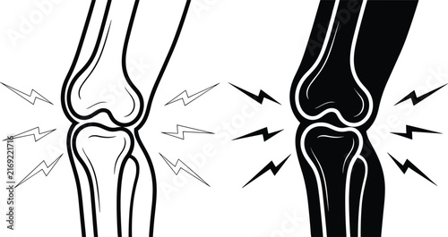 Knee joint pain vector icon set showing human leg bone ache injury arthritis or inflammation with lightning symbols