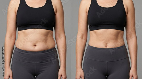 Before and After: Woman's Fitness Transformation, Weight Loss Progress