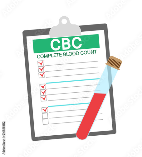 Complete blood count test results on clipboard with blood sample vial. A medical laboratory test result form for a complete blood count is shown with a vial containing a red blood sample
