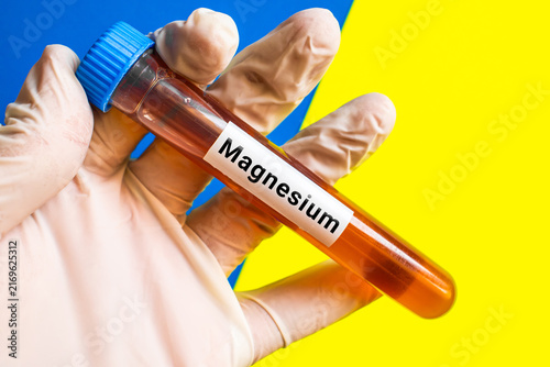 Fotografía blood sample in lab tube for Magnesium test
