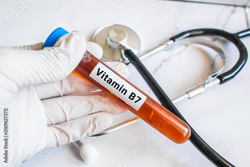 blood sample in lab test tube for Vitamin B7
