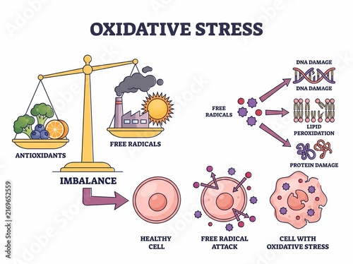Oxidative stress and antioxidant imbalance medical infographic