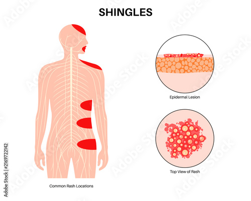 Naklejka Epidermal structure location infographic