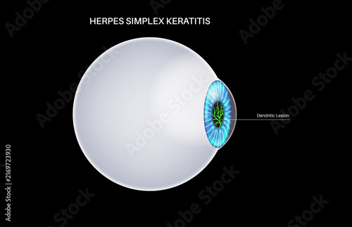 Naklejka Side angle view 3D infographic