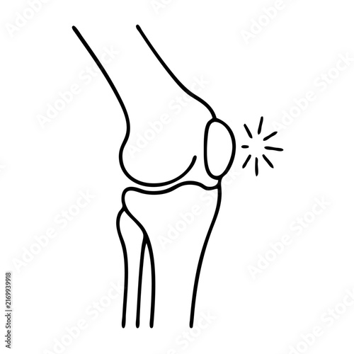 Knee pain icon showing joint inflammation and injury in a simple line art medical illustration.