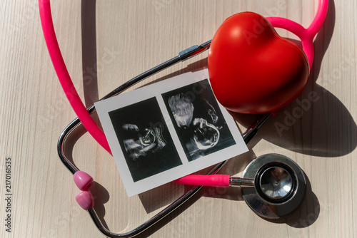 Foto Photo: Ultrasound screening of a child and stethoscope