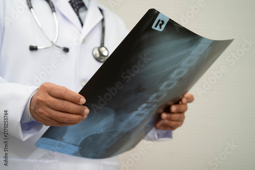 Картината върху платно Doctor examining spine bone radiography xray film.
