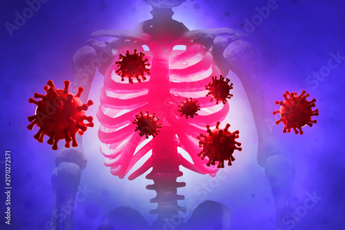 Obraz na płótnie Red virus infection in human chest