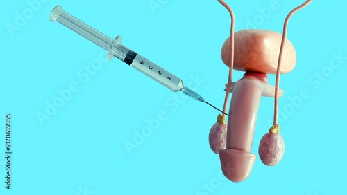 Cuadro en lienzo A 3D medical syringe targeting the male reproductive anatomical structure, a representation of intracavernosal injection therapy, urological treatment, and erectile dysfunction care