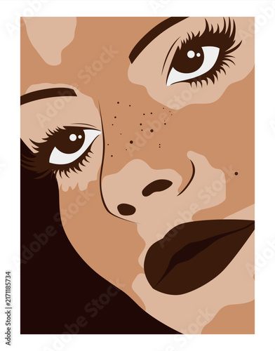 Woman with vitiligo close up portrait illustration