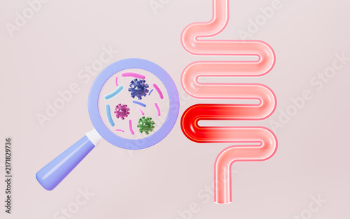 Fotografie Human intestines, enteritis, intestinal flora imbalance, etc