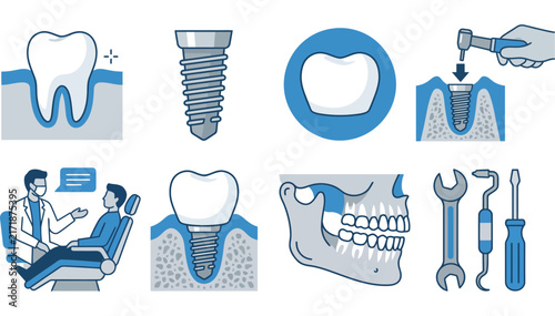 Set of dental implant procedure icons and medical tooth illustrations
