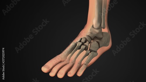 Ankle Injury With Highlighted Painful Joint