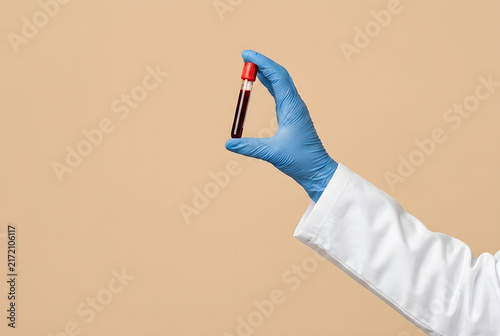 Blood test tube held by gloved hand with lab gown, doctor scientist, laboratory research, healthcare, disease diagnosis, World Blood Donor Day, medical campaign. beige background, copy space.