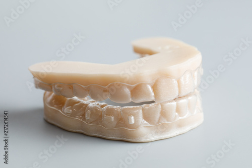 3D Printed Dental Aligners and Jaw Model
