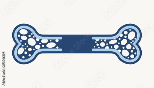 Anatomical bone structure vector illustration highlighting healthy dense ends and a broken porous center shaft.