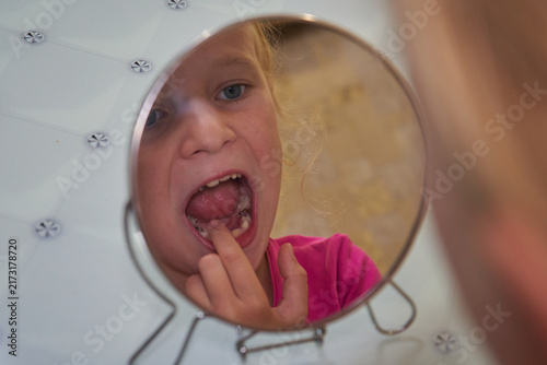 Little girl looking in mirror at her loose wobbly tooth, Little girl pointing at missing or growing tooth looking at her reflection