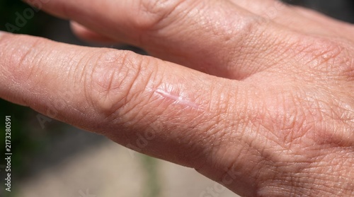 Close up view of human skin texture showing a linear scar or scratch on the finger detailed skin surface