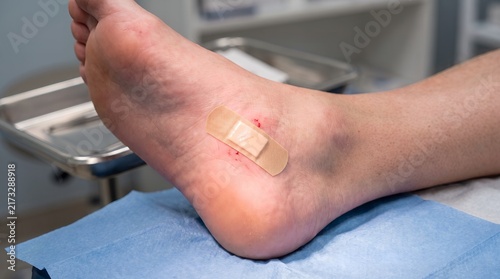 Foot ankle medical treatment and wound dressing care procedure for pain relief and healing
