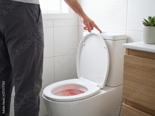Gross Hematuria Blood in Urine Symptom Awareness
