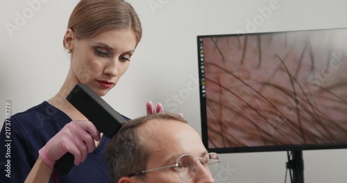 Hair clinic trichoscopy examination with handheld scanner and magnified monitor display, men with problem alopecia.