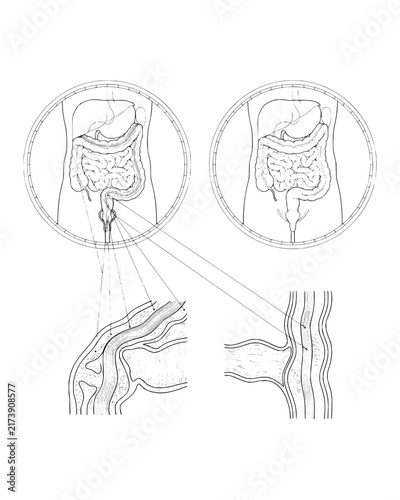 Human Digestive System Anatomy Diagram with Cross Section Details