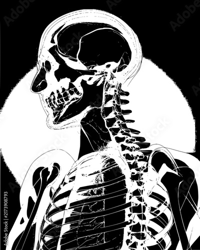 Stylized high contrast X-ray illustration of a human skull and ribcage on black background