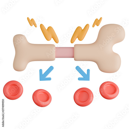 Bone marrow stimulated to produce red blood cells in erythropoiesis process medical 3D illustration.