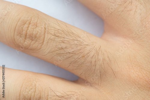 Hairy human skin, close view of male arm or leg, body hair, natural fur pattern
