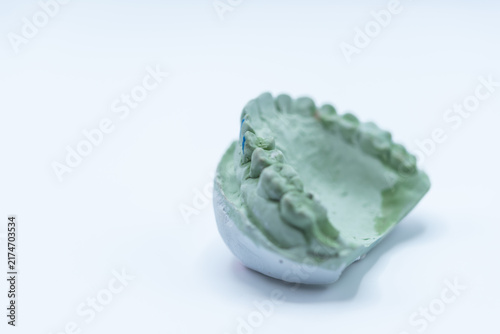Fotografie Dental impression model of upper teeth clean white background showing detailed t