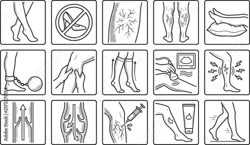 Black and white line icons illustrating varicose veins symptoms, prevention, and medical treatments also transparent background