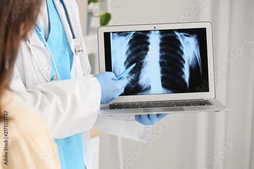 Male doctor showing x-ray scan of lungs on laptop to patient in clinic, closeup