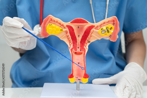 Fotografie Doctor holding human uterus model for vaginal and cervix pap smear check up in the obstetrics and gynecology