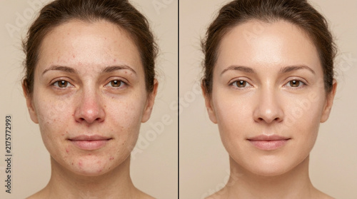Before and After: Woman's Face Transformation with Makeup - Skin Improvement
