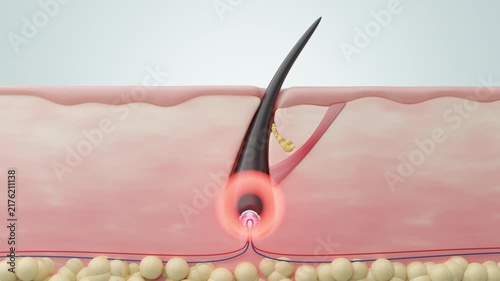 Hair Root Damage Warning and Scalp Structure Medical Concept 3D render