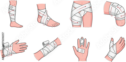 Medical Bandage Step by Step Application Guide Vector Icon Set for First Aid Training, Injury Treatment, and Healthcare Infographics