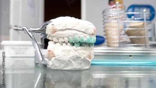 modeling of artificial teeth on a plaster model