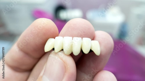 dental ceramic metal bridges in the hands
